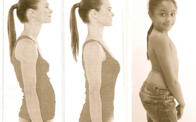 Apa itu postural sehat Lordosis?