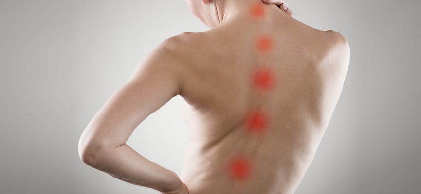 Pengaruh Vitamin D3 pada Skoliosis